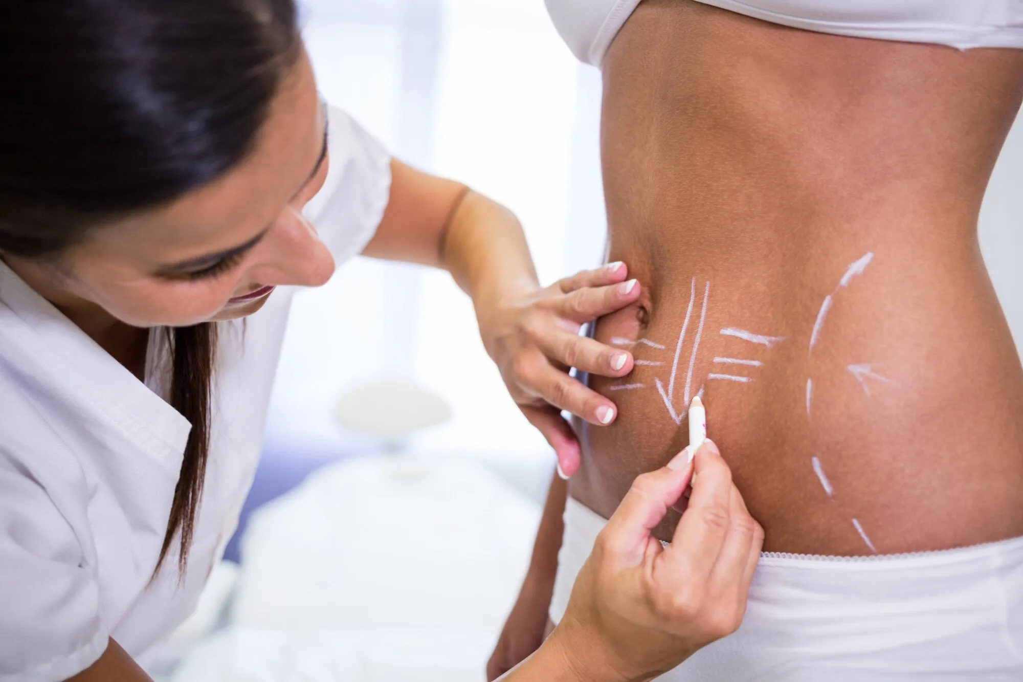 imgi_63_cirujano-dibujando-lineas-abdomen-mujer-liposuccion-eliminacion-celulitis_107420-7408