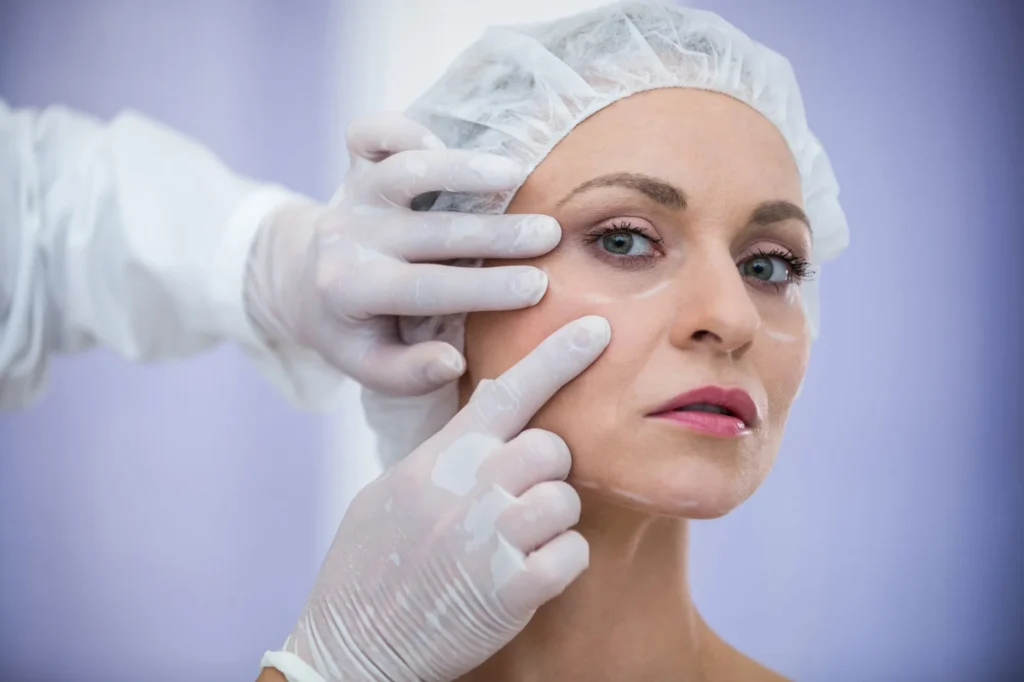 Blefaroplastia